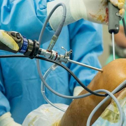 arthroscopic knee reconstructive surgery